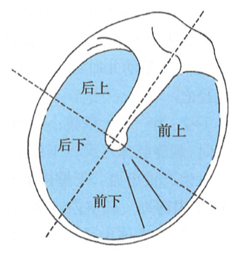 右耳鼓膜示意图