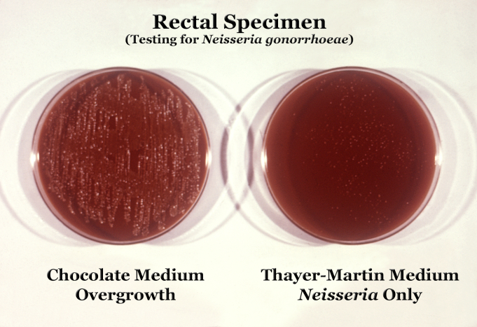 Neisseria gonorrhoeae